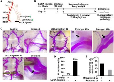 High wall shear stress-dependent podosome formation in a novel murine model of intracranial aneurysm